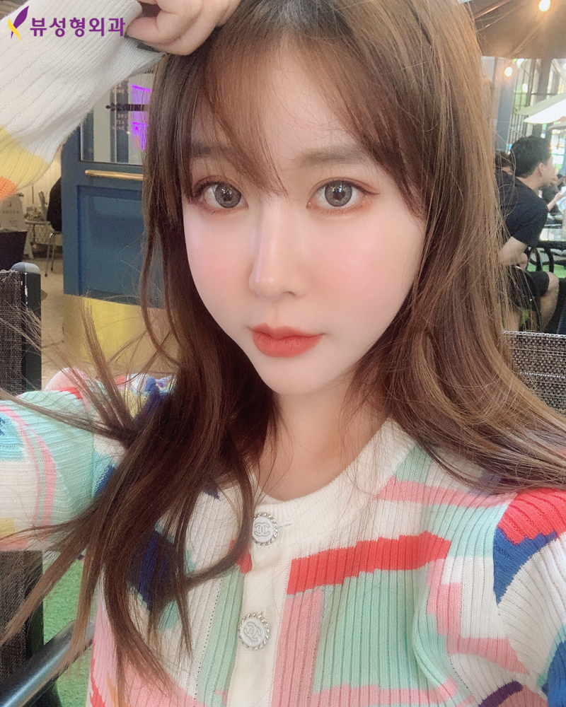 얼굴뼈성형 후 리프팅! 볼처짐 걱정말아요 관련 이미지 6