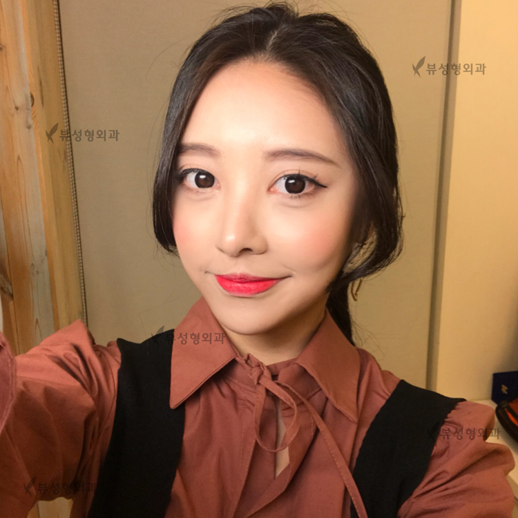 안면비대칭! 뷰에서 해결해봐! 관련 이미지 4