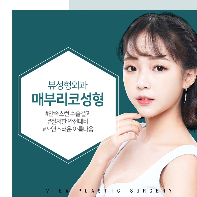 뷰성형외과 매부리코교정, 포인트는? 관련 이미지 8