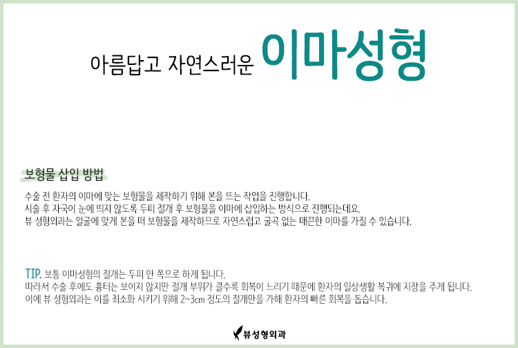 이마성형으로 아름답고 자연스러운 입체적인 페이스라인 관련 이미지 3
