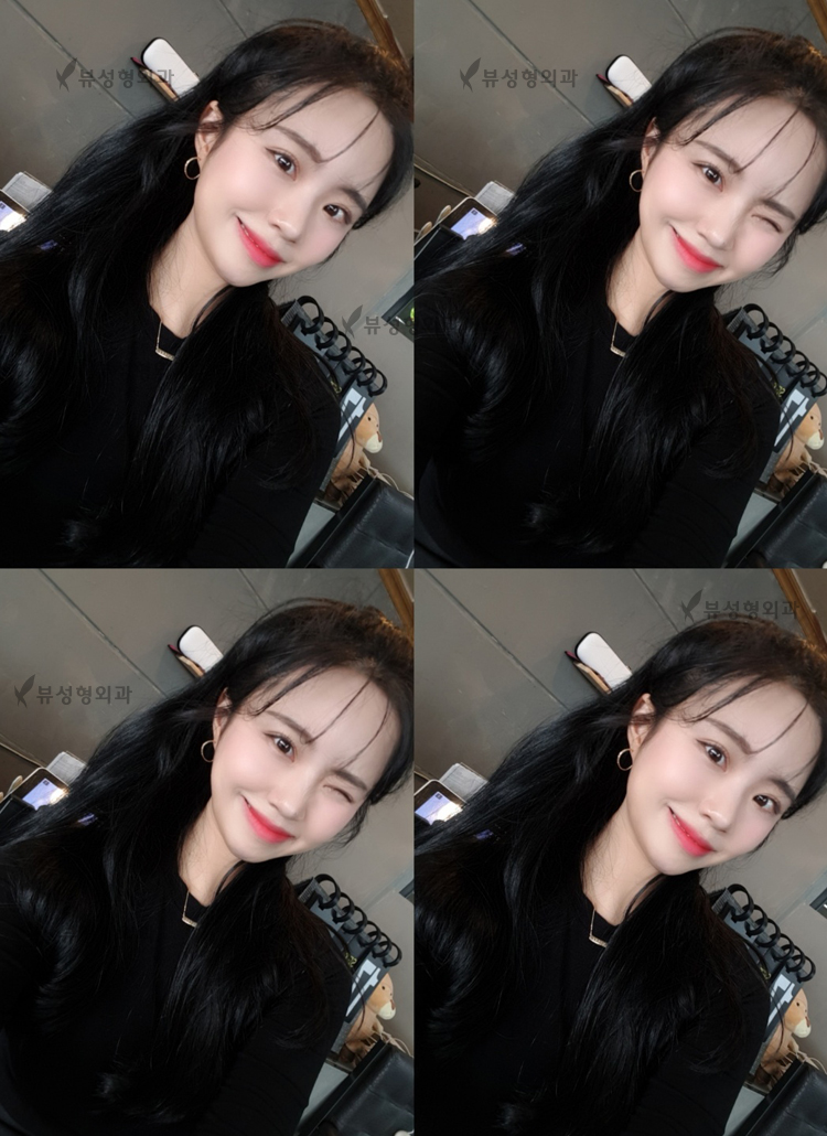 안면비대칭! 뷰에서 해결해봐! 관련 이미지 3