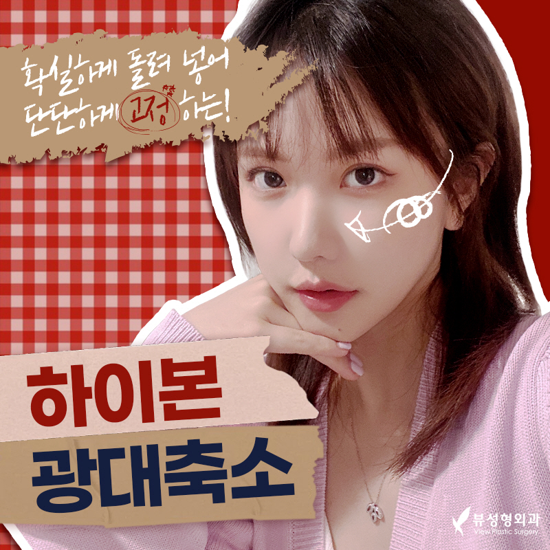 얼굴형의 밸런스를 맞춰주는 안면윤곽수술 관련 이미지 4