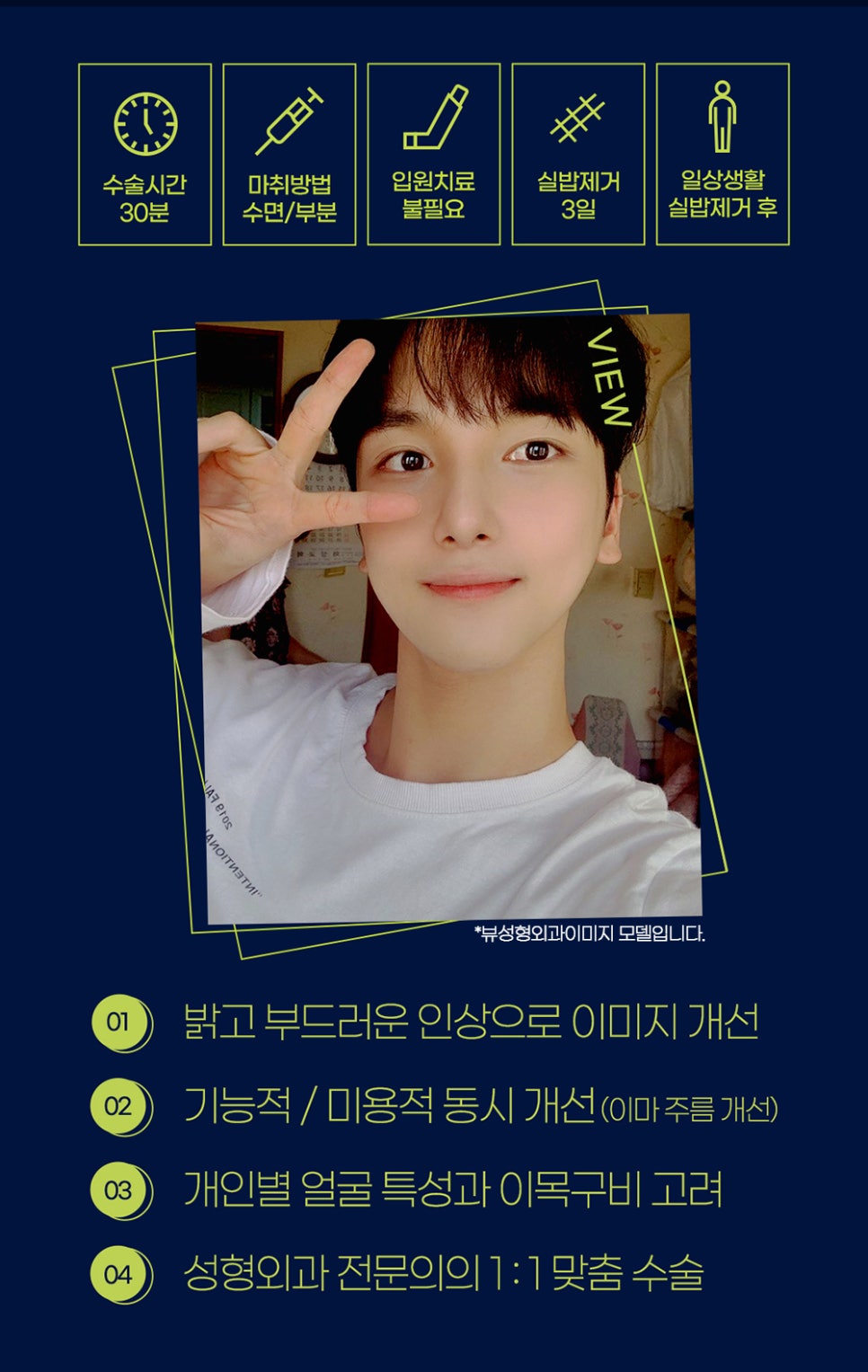 남자눈매교정 개인 상황에 맞춰 뷰에서 관련 이미지 3