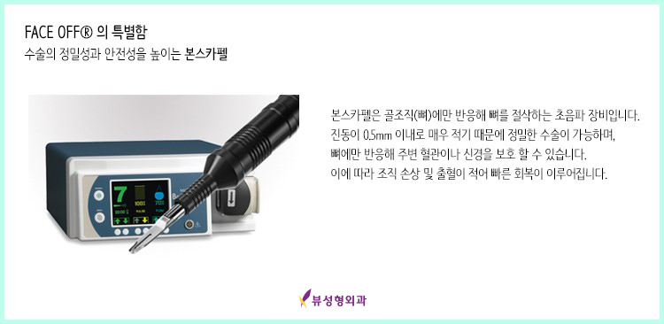 작고 부드러운 V라인? VIEW 페이스오프 관련 이미지 4