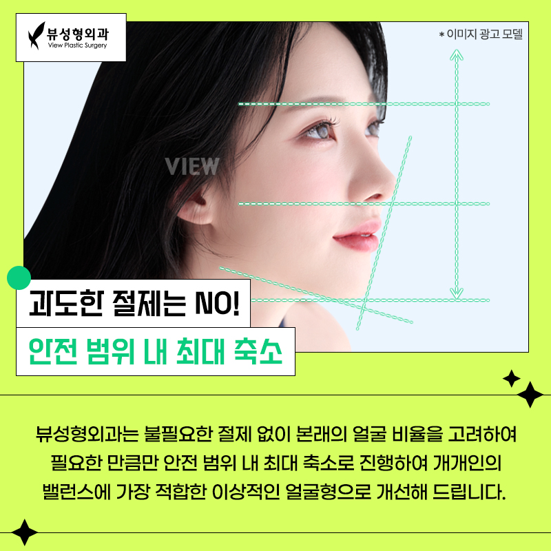 얼굴형의 밸런스를 맞춰주는 안면윤곽수술 관련 이미지 2