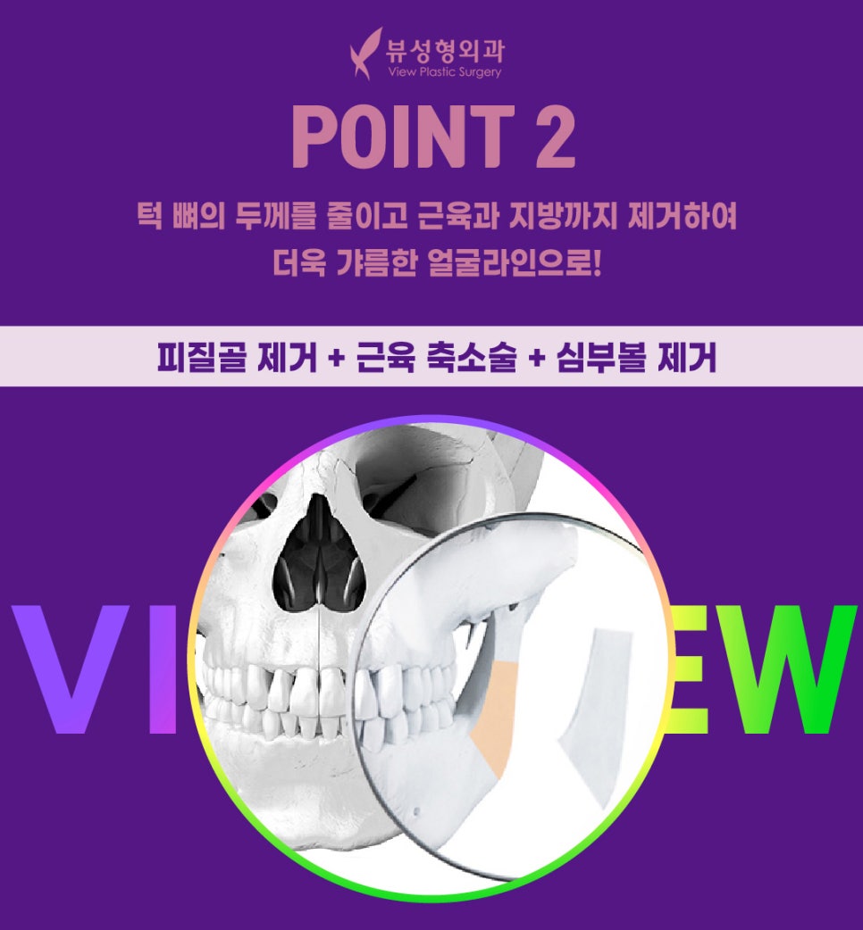 안면윤곽후기, 붓기는 얼마나 갈까? 관련 이미지 4