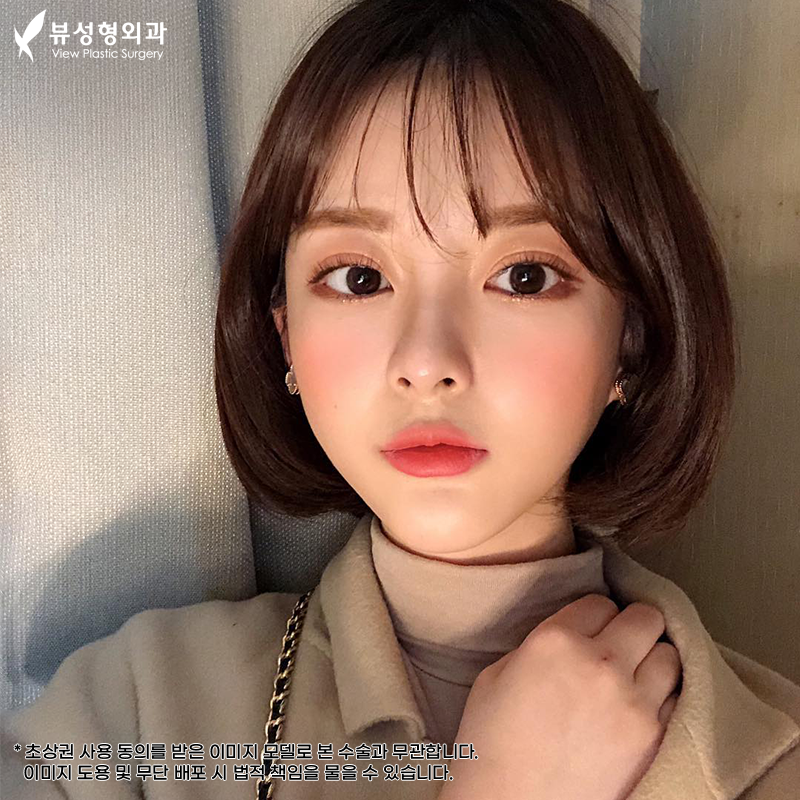 눈재수술유명한곳, 뷰성형외과 관련 이미지 1