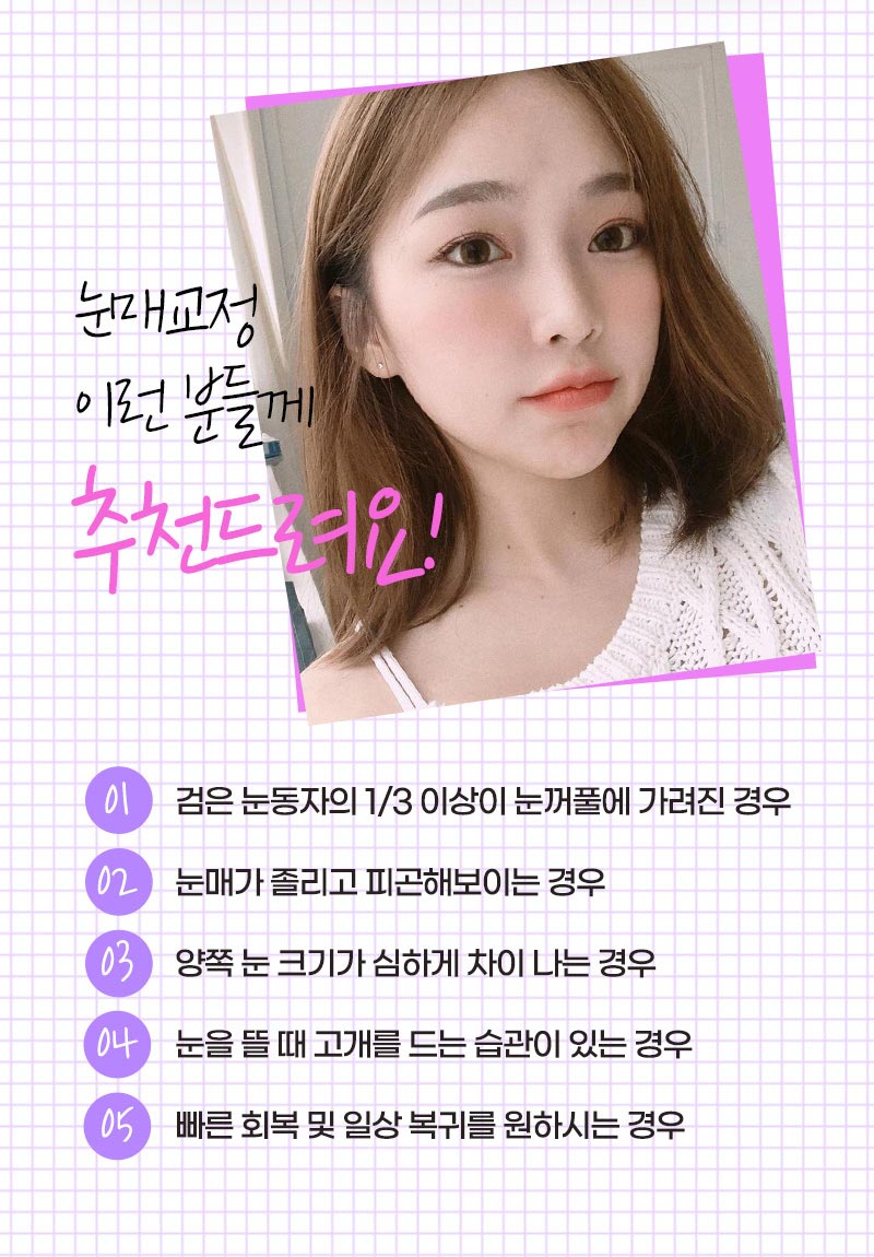 조화로운 비절개눈매교정 하고 싶다면 관련 이미지 10