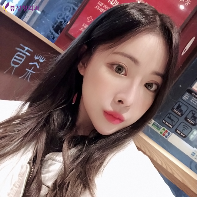 여자매부리코성형으로 여성미 한껏 뽐내봐요~! 관련 이미지 4