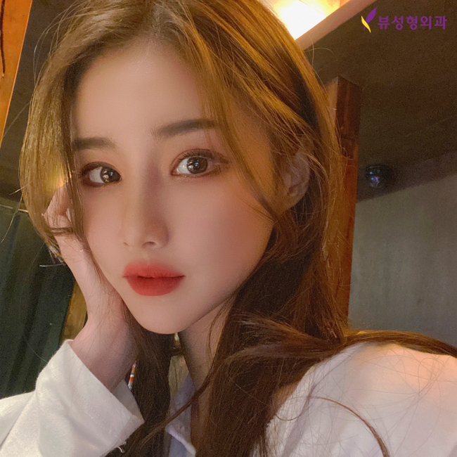 사각턱수술잘하는곳 뷰성형외과 긴곡선사각턱수술로 변화된 모습 관련 이미지 1