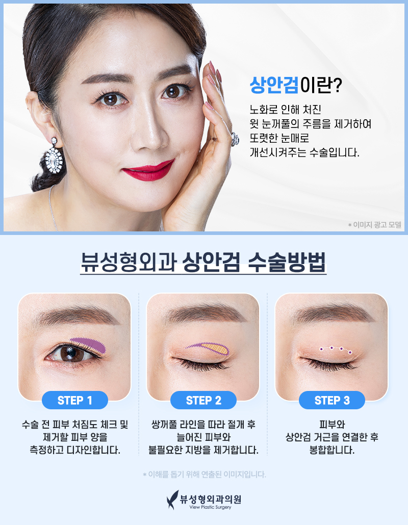 처지고 주름진 피부를 개선하는 동안성형 관련 이미지 6