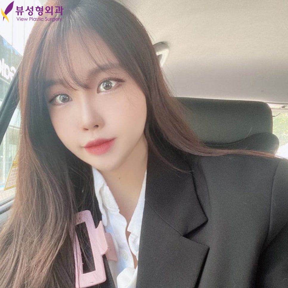 안면윤곽재수술 후기 | 발품 꿀팁 관련 이미지 1