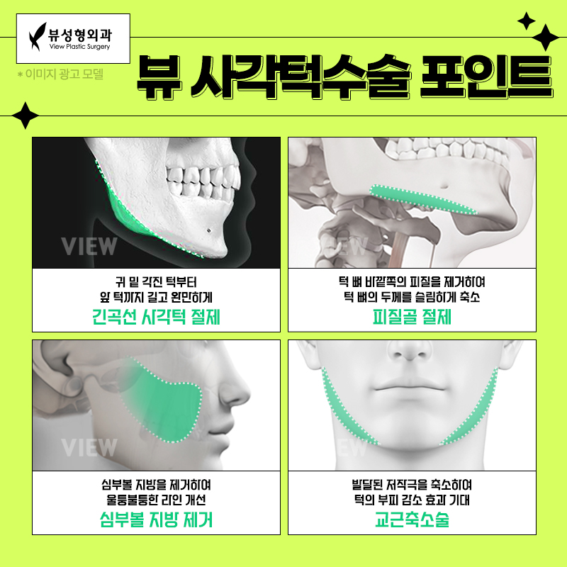 얼굴형의 밸런스를 맞춰주는 안면윤곽수술 관련 이미지 8