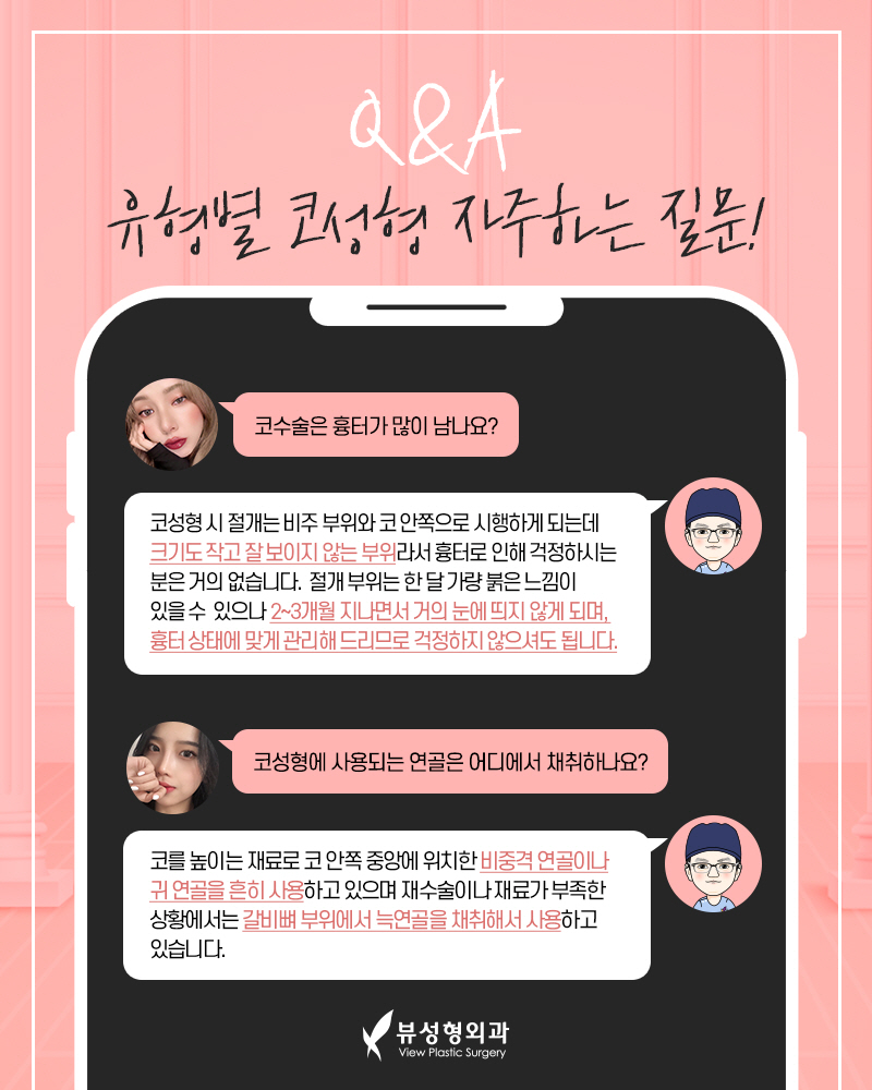 짧은코성형, 뷰에서 뷰티풀하게 관련 이미지 5