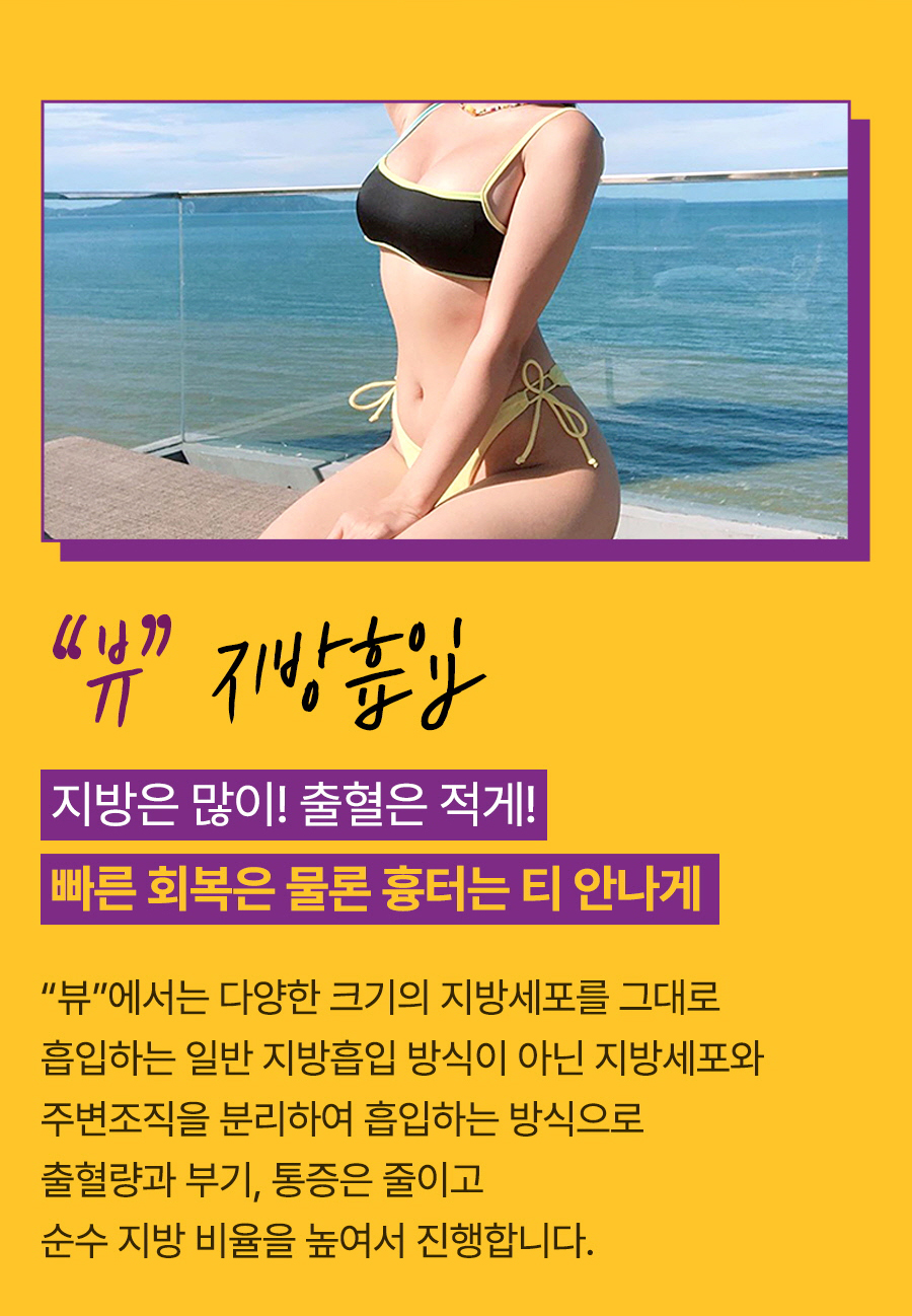 단기간내 눈에 띄는 지방 감량 방법, 지방흡입 관련 이미지 3
