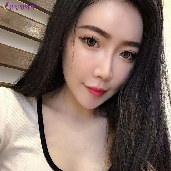 코수술후기 뷰성형외과에서 기대되는 만족감을 관련 이미지 1