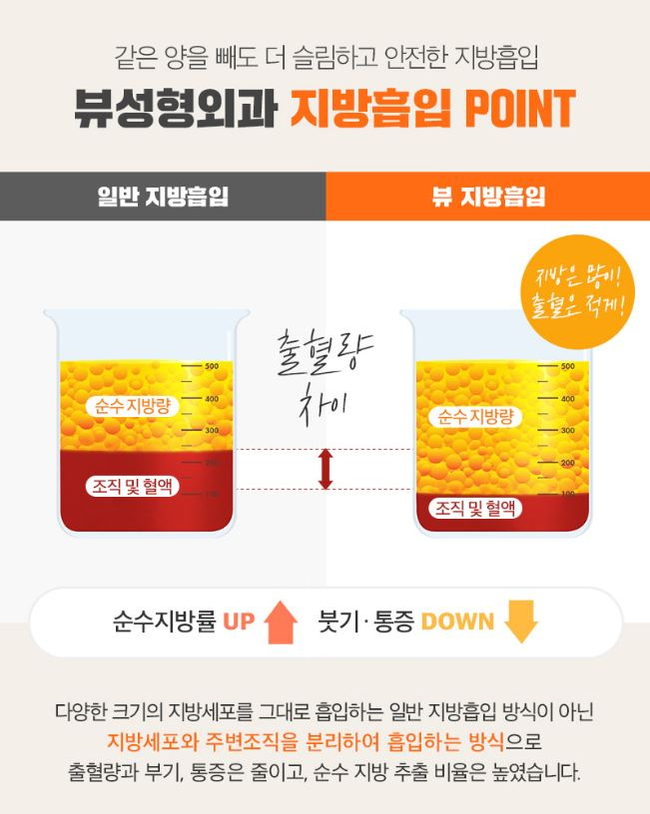 팔뚝지방흡입 슬림한 바디라인 뷰성형외과라면 관련 이미지 4