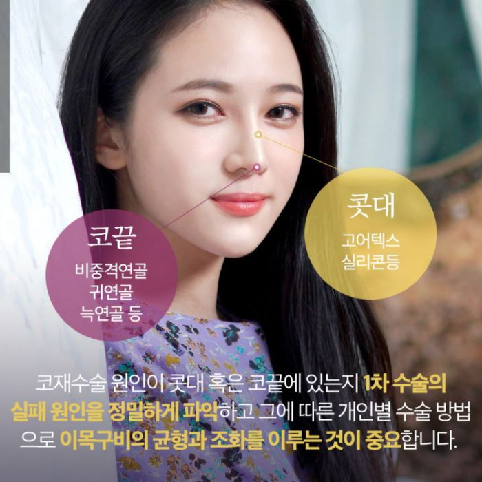 얼굴의 비율과 균형, 조화를 이루는 코성형 관련 이미지 14