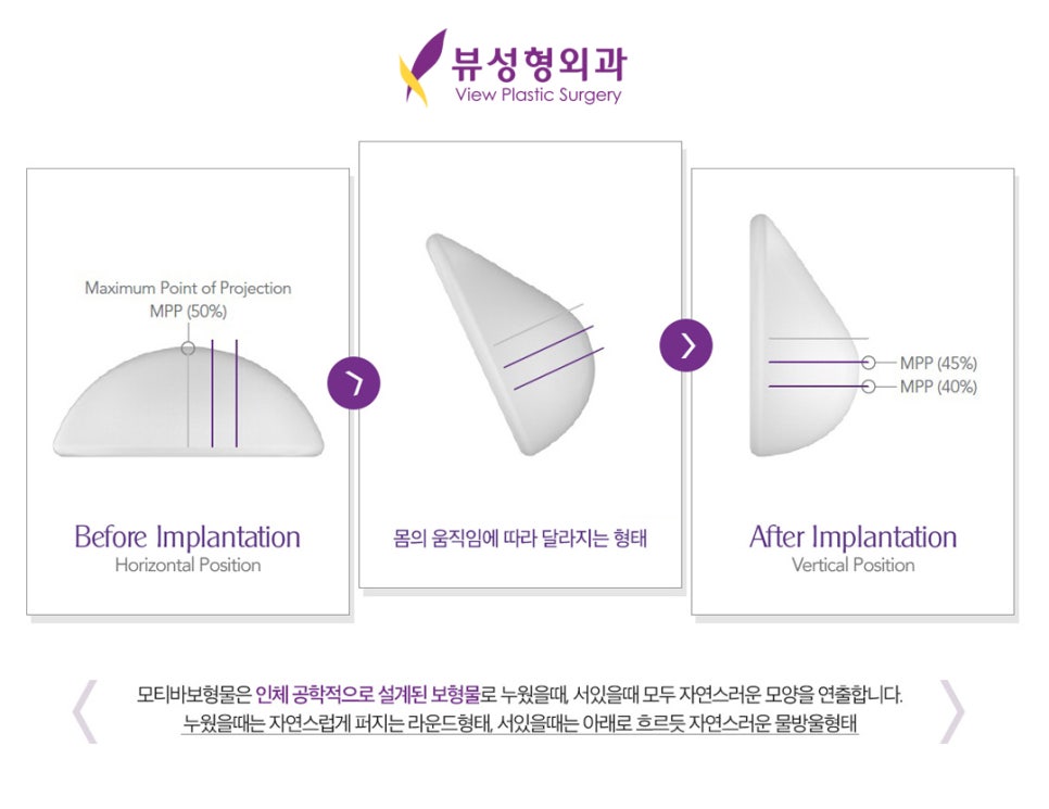 물방울가슴성형촉감 진짜처럼, (feat. 모티바) 관련 이미지 3