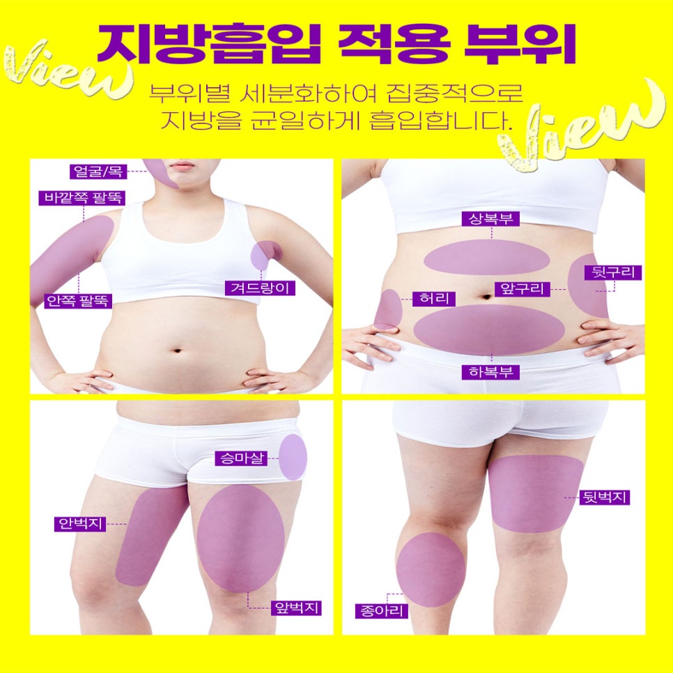 여자다이어트 스트레스 그만! +전후사진 관련 이미지 2