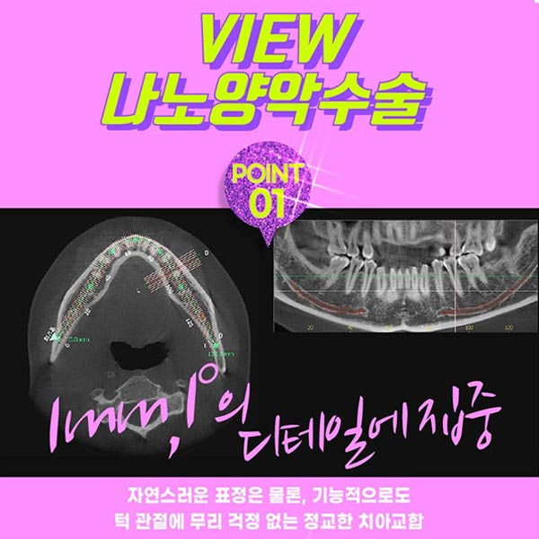 안면비대칭교정방법 자세히 알고 싶다면 관련 이미지 4