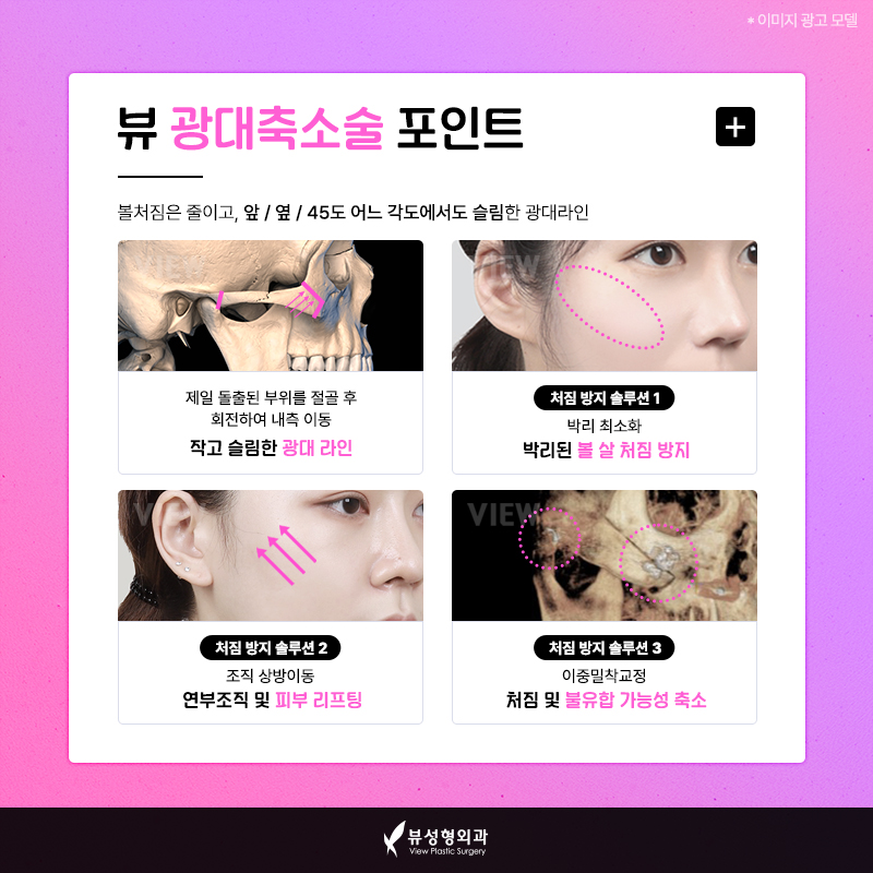 얼굴형의 밸런스를 맞춰주는 안면윤곽수술 관련 이미지 6