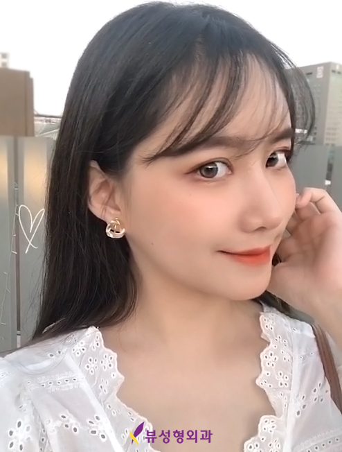 여자매부리코성형으로 여성미 한껏 뽐내봐요~! 관련 이미지 6