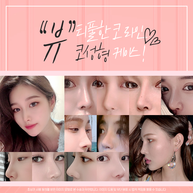 코성형, 개인별 유형에 적합한 수술방법은? 관련 이미지 3