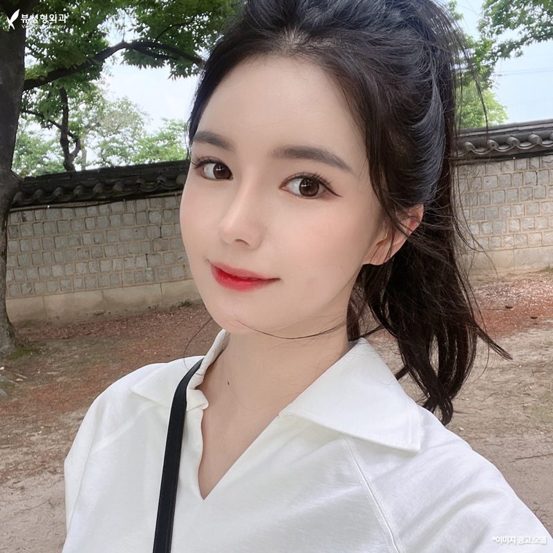 기능코성형외과, 이비인후과 중 어디서 해야 할까 관련 이미지 8