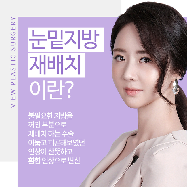 눈밑지방재배치 환해지는 인상 관련 이미지 3