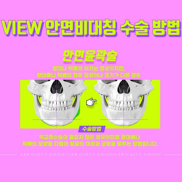 안면비대칭교정방법 자세히 알고 싶다면 관련 이미지 7