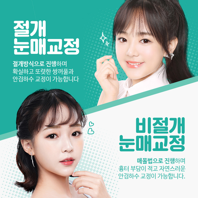 답답한 눈매 또렷해지려면? 뷰성형외과 눈매교정으로 관련 이미지 5