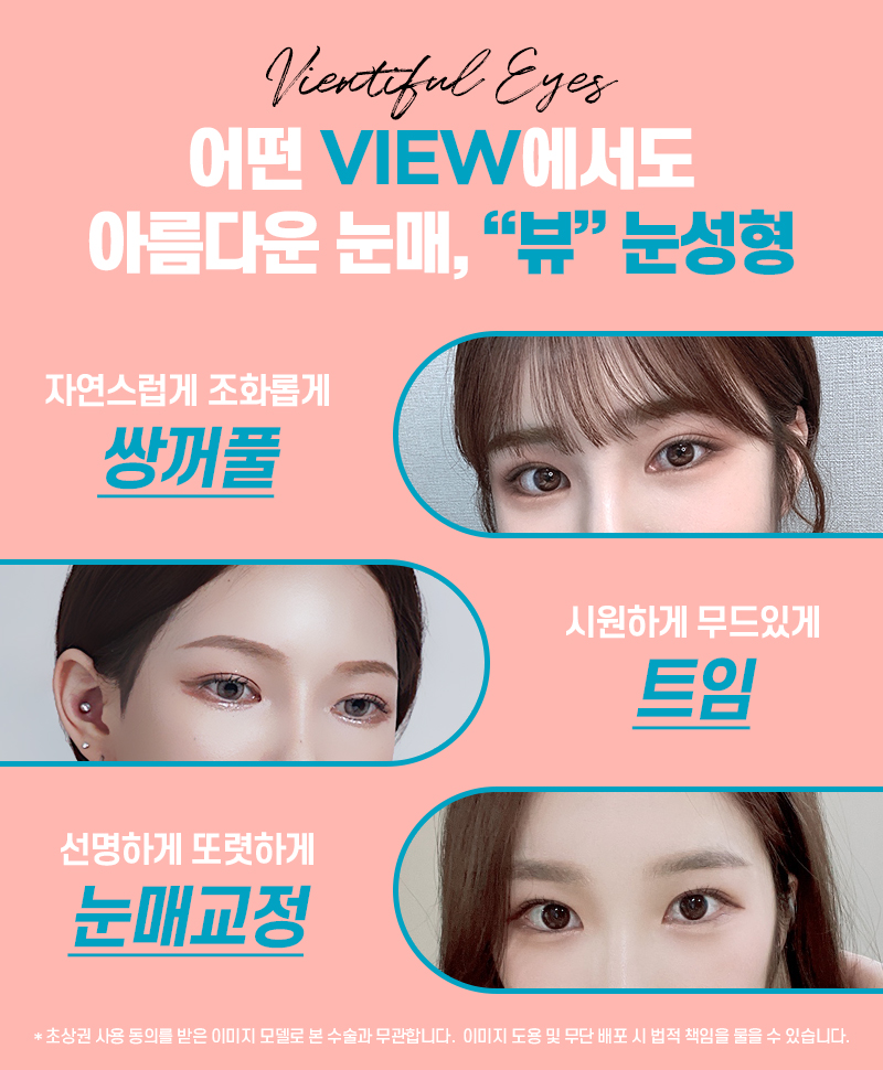 내게 맞는 눈성형을 위한 수술방법 알아보기 관련 이미지 3