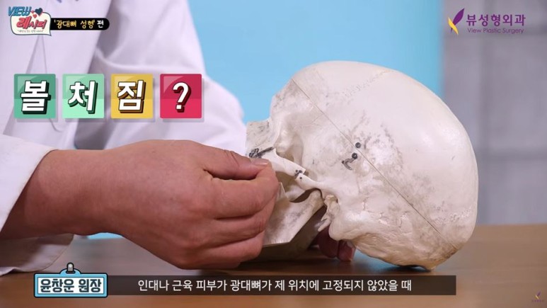 얼굴형의 밸런스를 맞춰주는 안면윤곽수술 관련 이미지 6
