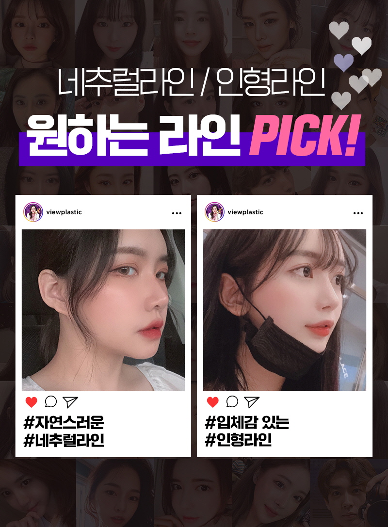 코성형, 개인별 유형에 적합한 수술방법은? 관련 이미지 9