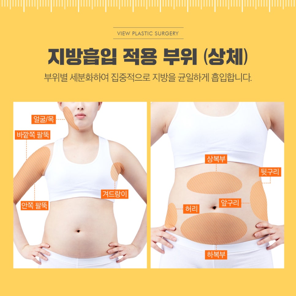 전신지방흡입, 라인과 탄력 그리고 안전까지! 관련 이미지 10