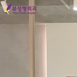 처진가슴수술 고민을 없애려면 관련 이미지 11