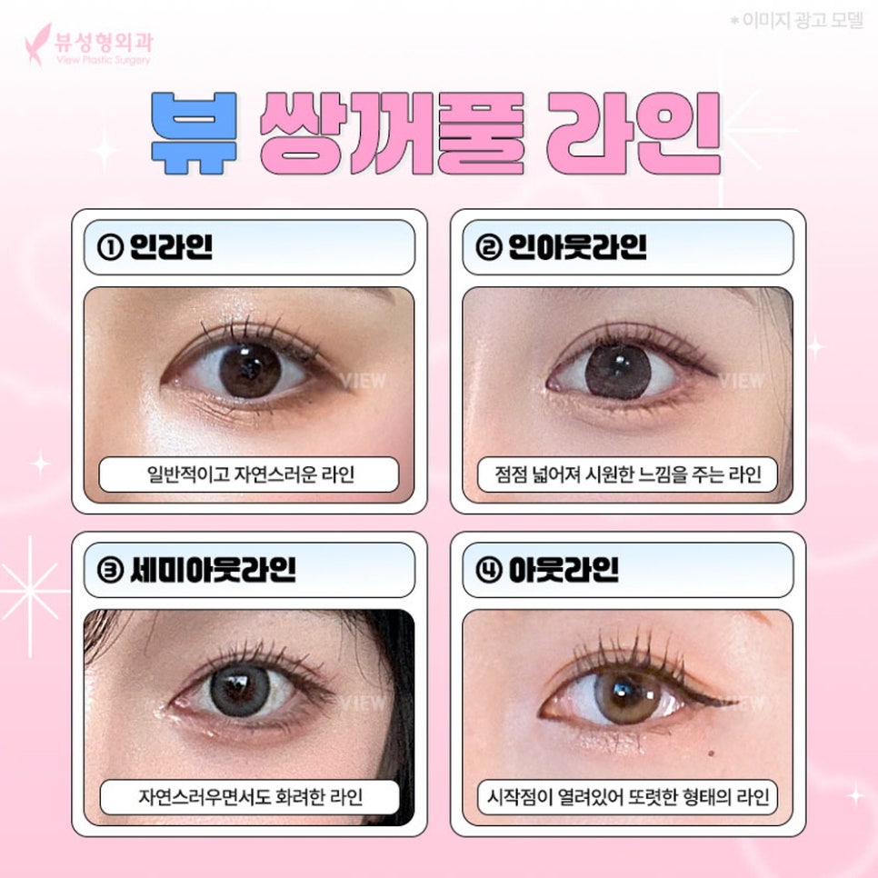 내게 맞는 눈성형 알아보기 관련 이미지 6
