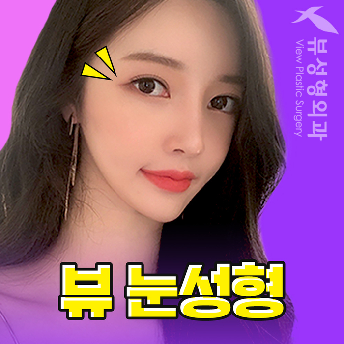 나만의 눈성형을 위한 수술방법 알아보기 관련 이미지 5