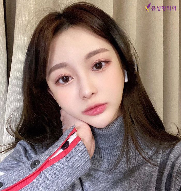 엘라스티꿈 얼굴실리프팅은 달라요! 관련 이미지 5