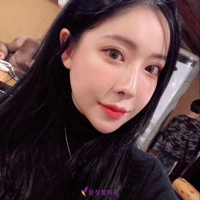 수술 후 관리까지 꼼꼼한 뷰티풀 코성형 관련 이미지 2