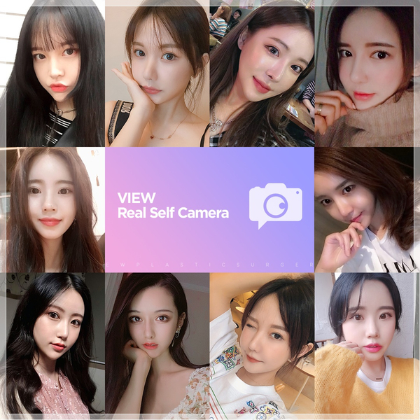 뭉툭한 코끝, 뷰성형외과 복코수술로 슬림하게~! 관련 이미지 9