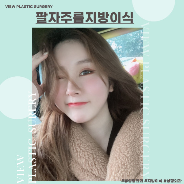 팔자주름지방이식 으로 젊어지자! 관련 이미지 1