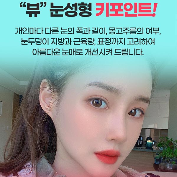 쌍꺼풀수술종류 알아보기 관련 이미지 3