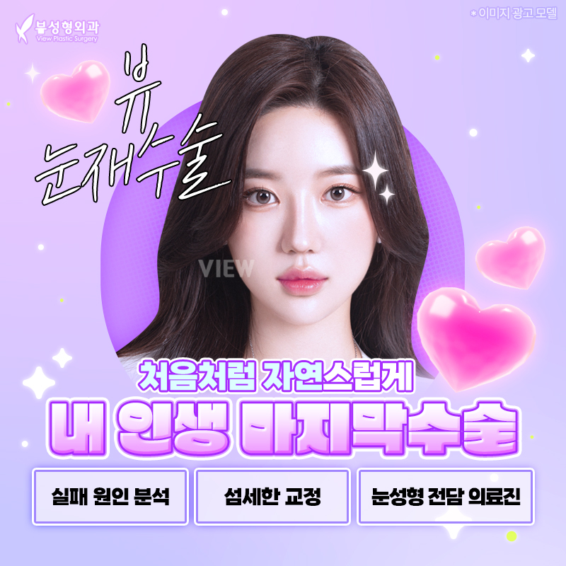 재수술만 4번째..이게 맞아? I 재수술 Q&A 관련 이미지 1