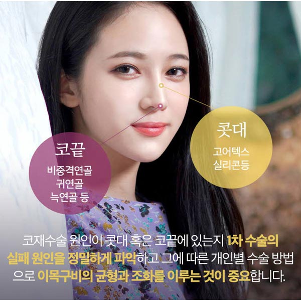 코재수술성형외과 찾고있다면 뷰성형외과로 관련 이미지 6