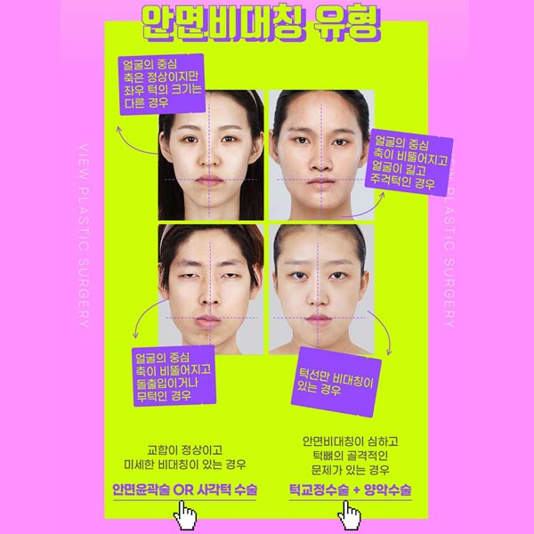 안면비대칭교정방법 자세히 알고 싶다면 관련 이미지 6