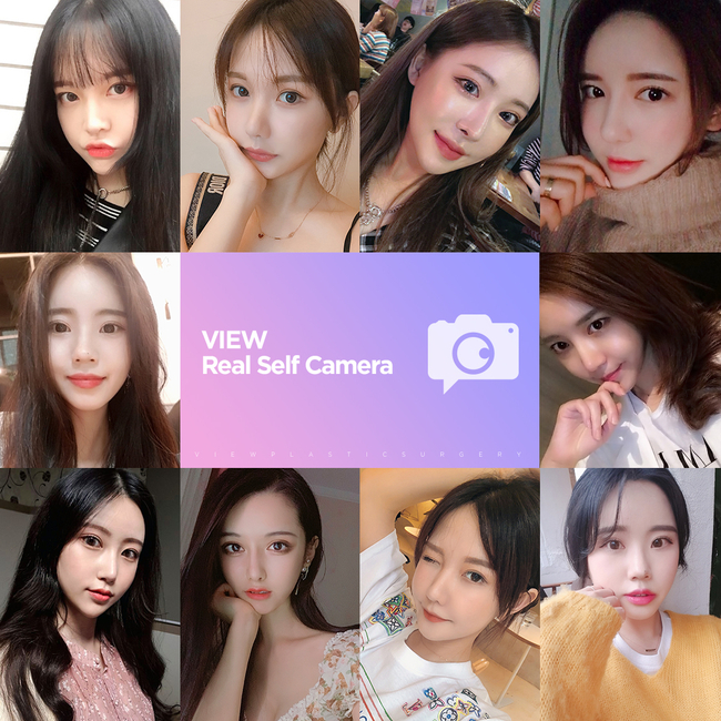 뷰성형외과 트임성형수술로 예쁨 충전 완료&hearts; 관련 이미지 9