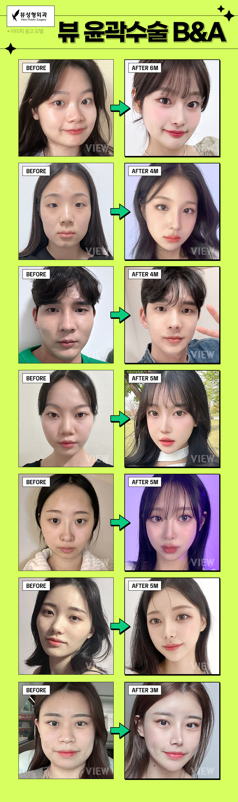 윤곽3종으로 내 숨겨진 아름다움을 알아보기🤩 관련 이미지 14