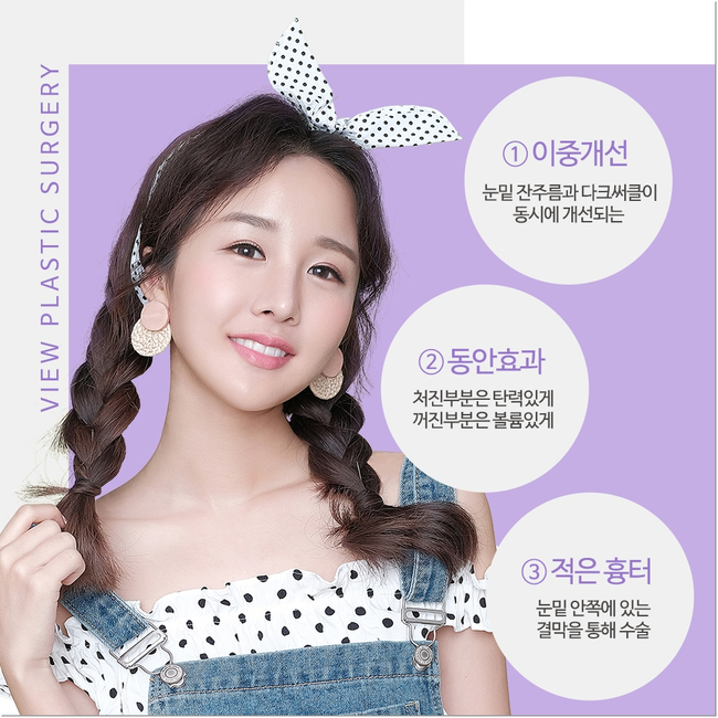 눈밑지방재배치로 인상이 확 달라졌어요.&hearts; 관련 이미지 3